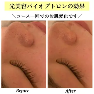 Bellesthe （ベルエステ）のエステ・リラクイメージ