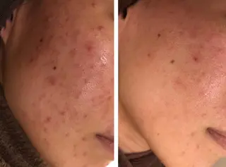 ミディアム カラー パーマ ヘアアレンジ メンズ キッズ ネイル マツエク・マツパ ニキビ・肌質改善専門 ♡人生が変わるサロンのエステ・リラクイメージ