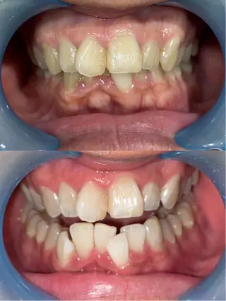 メンズ ホワイトニングサロン SHILONのエステ・リラクイメージ