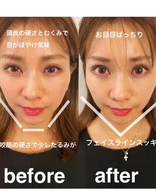 美容鍼灸サロン mahoroba院長のエステ・リラクイメージ