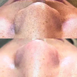 abbellina×UNO出雲塩冶店《ウノ》所属・フェイシャルエステ 🫧琉衣のエステ・リラクイメージ