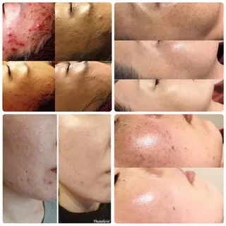 ネイル Private salon Dux所属・肌管理&nail Salon  Duxのエステ・リラクイメージ