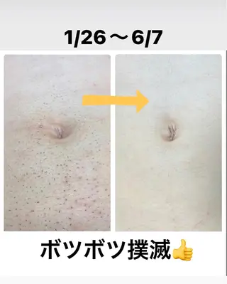 メンズ メンズ脱毛サロン Le falcoのエステ・リラクイメージ