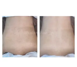 肌質改善 KALANCHOEのエステ・リラクイメージ