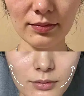 ネイル aliaハイフ&水光ジェットサロン所属・aliaハーブ水光店 エステティシャン募集のエステ・リラクイメージ