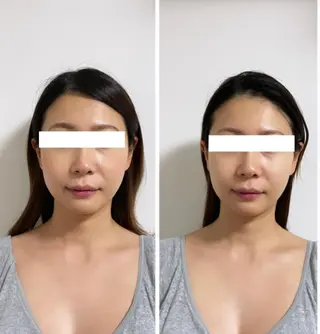 自律神経を整える フェイシャルエステのエステ・リラクイメージ