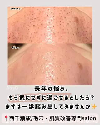 AxO Aestheticのエステ・リラクイメージ