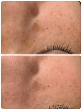 Lien オーナー　山口智嘉のエステ・リラクイメージ