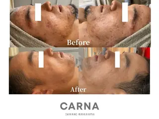 メンズ CARNA所属・【肌質改善専門店】 CARNAのエステ・リラクイメージ