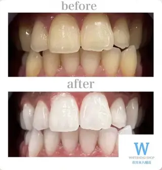 ホワイトニング ショップ本八幡店のエステ・リラクイメージ