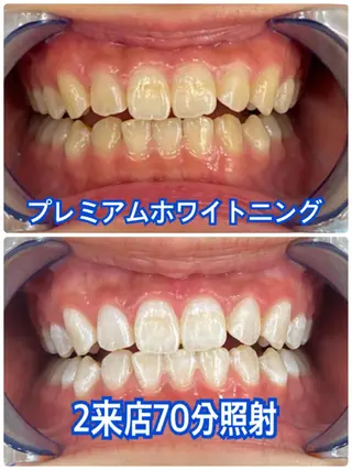 Platinum Beauty 四条烏丸店所属・吉田亮利 ホワイトニング専門店のその他イメージ