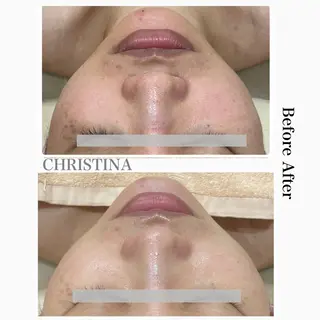 エステ矢野 ジョアアンジェ心斎橋のエステ・リラクイメージ