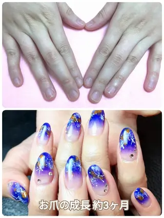 ネイル 深爪矯正/爪育成ケア manie nailのネイルデザイン