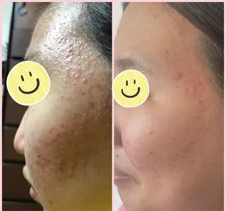 Narisビューティサロン デアイム所属・ささき ひとみのエステ・リラクイメージ