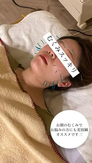 美容鍼/ヘッドスパ/ 💎さかもとのエステ・リラクイメージ