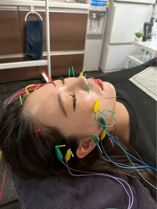 美容鍼・小顔矯正 FLOW 鍼灸整体院のその他イメージ