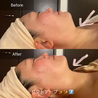 Mandarin Orange所属・毛穴から始める肌メン テマンダリンオレンジのエステ・リラクイメージ