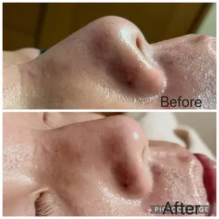 Shelly Graceのエステ・リラクイメージ