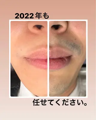 メンズ メンズ脱毛サロン Le falcoのエステ・リラクイメージ