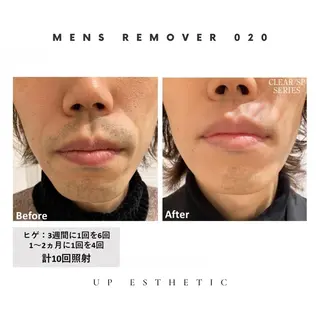 メンズ ウプエステティック所属・韓国肌管理 ウプエステティックのエステ・リラクイメージ