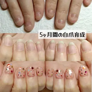 ネイル 深爪矯正/爪育成ケア manie nailのネイルデザイン