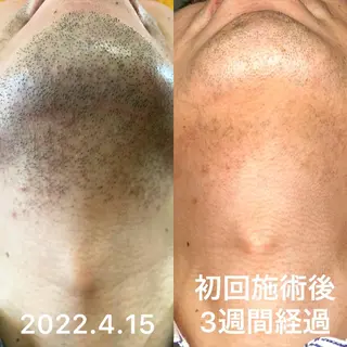 akua... 【肌質管理専門】のその他イメージ