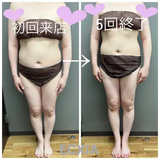 ECXIA 【エクシア】のエステ・リラクイメージ