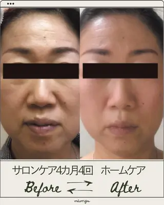 ヴェルーリヤ ビューティーデザインのエステ・リラクイメージ