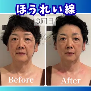 💎小顔サロン アリリン銀座💎のエステ・リラクイメージ