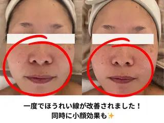 Total Beauty salon Bloom所属・肌育WISHpro 専門サロンBloomのエステ・リラクイメージ