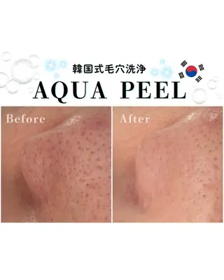 HETIY by Seoul所属・韓国肌管理🇰🇷 水光肌/肌質改善🫧のエステ・リラクイメージ