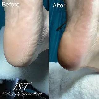 ネイル メンズ歓迎🙆‍♀️ エステ/ネイルISTのネイルデザイン