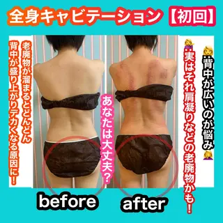 痩身/脱毛/ネイル HARUKAのエステ・リラクイメージ