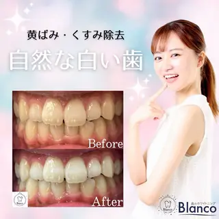 Blanco川口駅前店所属・Blanco 川口駅前店のその他イメージ