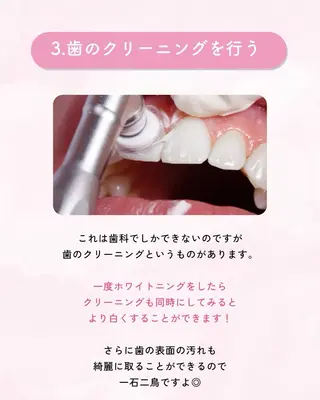 セルフホワイトニング エクシア大曽根店のその他イメージ