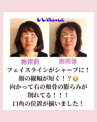 痩身・小顔・骨盤矯正×ヒップアップ専門エステ Peach所属・桃尻つかさ🍑小顔× ノーファンデ肌作りのエステ・リラクイメージ