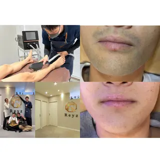 メンズ脱毛サロンReyz（レイズ）所属・熊本メンズ脱毛サロン Reyz（レイズ）のエステ・リラクイメージ