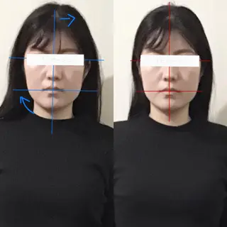 顔の歪み矯正専門 宮内翔のエステ・リラクイメージ