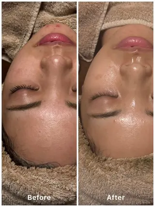 Flourb所属・ハーブピーリング専門 サロンFlourbのエステ・リラクイメージ