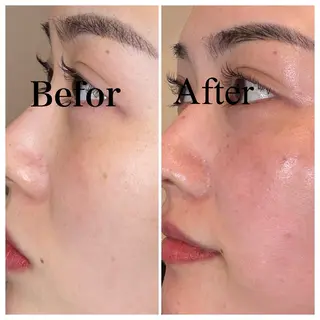 美肌管理サロン　ペルボヌール所属・韓国美肌管理サロン ペルボヌールのエステ・リラクイメージ