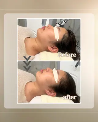 Salon ÉTOA【サロンエトア】所属・Salon ÉTOA harukaのエステ・リラクイメージ