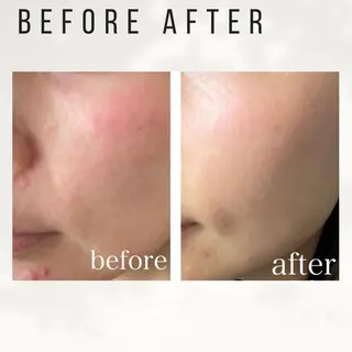 Beauty salon ハピー所属・大人女性のための 肌管理サロン　ハピーのエステ・リラクイメージ