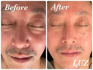 メンズ メンズフェイシャル アイブロウ・ルースのエステ・リラクイメージ