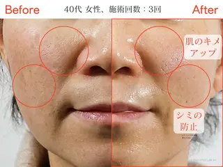 韓国肌管理専門店 Clear Labo クリアラボ 上野 【毛穴洗浄/ハイドラ/ピーリング】所属・Clear Lab 上野店のエステ・リラクイメージ