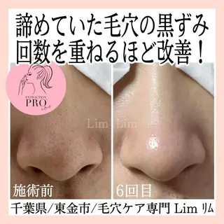 Lim Naomiのマツエク・マツパデザイン