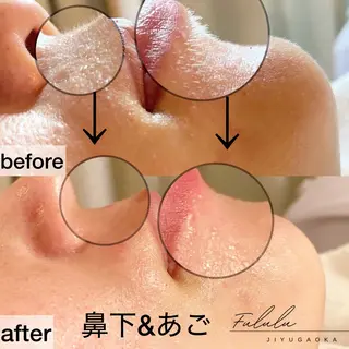 毛穴専門サロン　フルール所属・フルールFululu 自由が丘のエステ・リラクイメージ