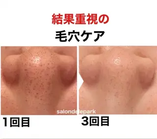 毛穴シミ改善専門 サロンド・ルパークのエステ・リラクイメージ