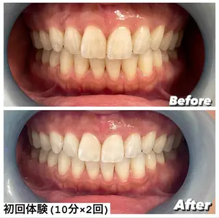 ホワイトニング専門店 Hi-Whiteのその他イメージ
