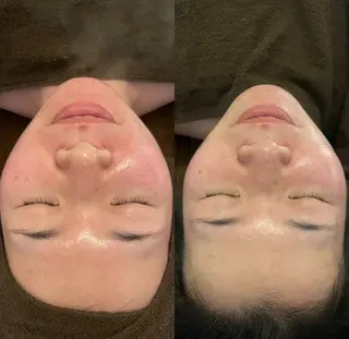 oyam オヤムのエステ・リラクイメージ