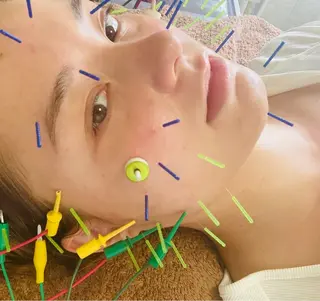 美容鍼灸サロン mahoroba院長のエステ・リラクイメージ